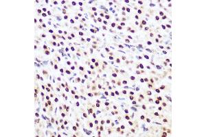 Immunohistochemistry of paraffin-embedded rat ovary using SP3 Rabbit pAb (ABIN6130701, ABIN6148314, ABIN6148315 and ABIN6216542) at dilution of 1:100 (40x lens). (Sp3 抗体  (AA 240-350))