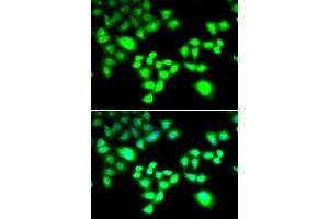 Immunofluorescence analysis of MCF-7 cells using RAD1 antibody (ABIN5995531). (RAD1 抗体)