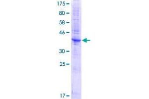 Image no. 1 for Transmembrane 4 L Six Family Member 1 (TM4SF1) (AA 1-202) protein (GST tag) (ABIN1322902)