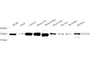 Western blot analysis of SLC22A1 (ABIN7075663) at dilution of 1: 1000 (SLC22A1 抗体)