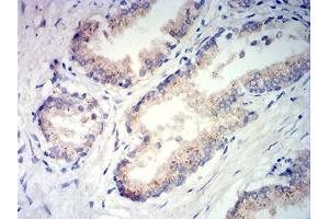 Immunohistochemical analysis of paraffin-embedded prostate tissues using PSAP mouse mAb with DAB staining. (Prosaposin 抗体  (AA 17-216))