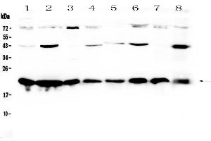 Western blot analysis of HP1 gamma using anti-HP1 gamma antibody . (CBX3 抗体  (AA 2-183))