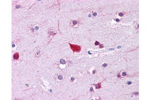 Immunohistochemistry (IHC) image for anti-Fatty Acid Binding Protein 4, Adipocyte (FABP4) (Middle Region) antibody (ABIN2778217) (FABP4 抗体  (Middle Region))