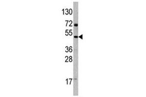 Western blot analysis of VEGFD antibody and 293 lysate (VEGFD 抗体  (AA 322-352))