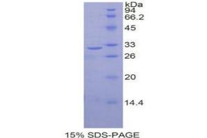 SDS-PAGE analysis of Human RELB Protein. (RELB 蛋白)