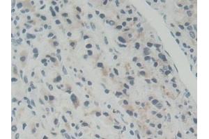 Immunohistochemistry (IHC) image for anti-ATP-Binding Cassette, Sub-Family B (MDR/TAP), Member 5 (ABCB5) (AA 570-808) antibody (ABIN7442258)