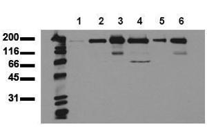 Western Blotting (WB) image for anti-Receptor Tyrosine-Protein Kinase ErbB-3 (ERBB3) (AA 1250-1270), (Cytoplasmic Domain) antibody (ABIN126794) (ERBB3 抗体  (Cytoplasmic Domain))