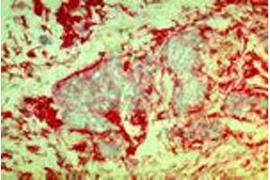Invasive mammary carcinoma cells (MAb DF5, b1-Integrin) (ITGB1 抗体)