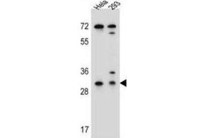 Western Blotting (WB) image for anti-Ephrin B2 (EFNB2) antibody (ABIN2996297) (Ephrin B2 抗体)