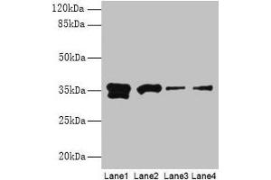 Western blot All lanes: APEX1 antibody at 2 μg/mL Lane 1: Hela whole cell lysate Lane 2: Mouse brain tissue Lane 3: MCF-7 whole cell lysate Lane 4: A431 whole cell lysate Secondary Goat polyclonal to rabbit IgG at 1/15000 dilution Predicted band size: 36 kDa Observed band size: 36 kDa (APEX1 抗体  (AA 32-318))