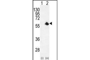 Western blot analysis of CDK8 (arrow) using rabbit polyclonal CDK8 Antibody (Center) (ABIN655911 and ABIN2845310). (CDK8 抗体  (AA 249-277))