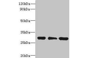 Western blot All lanes: HDHD3 antibody at 1 μg/mL Lane 1: Mouse small intestine tissue Lane 2: HT29 whole cell lysate Lane 3: COLO205 whole cell lysate Secondary Goat polyclonal to rabbit IgG at 1/10000 dilution Predicted band size: 28 kDa Observed band size: 28 kDa (HDHD3 抗体  (AA 1-251))