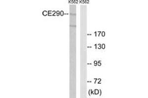 Western blot analysis of extracts from K562 cells, using CEP290 Antibody. (CEP290 抗体  (AA 771-820))
