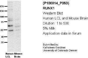 Image no. 3 for anti-Runt-Related Transcription Factor 1 (RUNX1) (Middle Region) antibody (ABIN2792598) (RUNX1 抗体  (Middle Region))