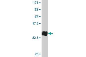 Western Blot detection against Immunogen (35. (CD19 抗体  (AA 98-187))