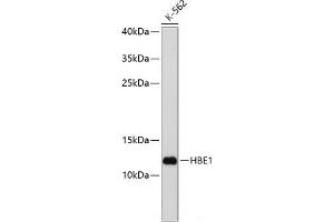 Western blot analysis of extracts of K-562 cells using HBE1 Polyclonal Antibody at dilution of 1:1000. (Hemoglobin, epsilon 1 (HBe1) 抗体)