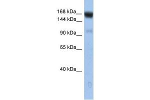 UBE4B antibody used at 1 ug/ml to detect target protein. (UBE4B 抗体)
