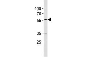 Western Blotting (WB) image for anti-Nicotinamide phosphoribosyltransferase (NAMPT) (AA 400-426) antibody (ABIN3031997)