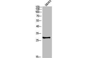 Western blot analysis of SKOV3 using p-PP2A-Cα (Y307) antibody. (PPP2CA 抗体  (pTyr307))
