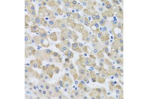 Immunohistochemistry of paraffin-embedded human liver injury using SNAP29 antibody. (SNAP29 抗体  (AA 1-258))