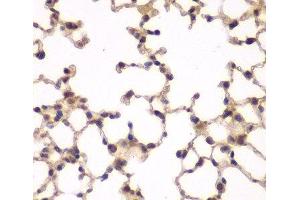 Immunohistochemistry (Paraffin-embedded Sections) (IHC (p)) image for anti-Phosphatidylinositol-5-Phosphate 4-Kinase, Type II, alpha (PIP4K2A) antibody (ABIN7263459)