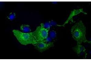 Anti-KIAA1609 mouse monoclonal antibody (ABIN2453202) immunofluorescent staining of COS7 cells transiently transfected by pCMV6-ENTRY KIAA1609 (RC209287). (KIAA1609 抗体)