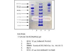 Gel Scan of Butyrylcholinesterase, Human Plasma  This information is representative of the product ART prepares, but is not lot specific. (Butyrylcholinesterase Protein (BCHE))