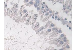 Immunohistochemistry (IHC) image for anti-phosphodiesterase 4B, cAMP-Specific (PDE4B) (AA 500-736) antibody (ABIN7442141)