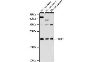 Western blot analysis of extracts of various cell lines, using SDHD antibody (ABIN7270622) at 1:3000 dilution. (SDHD 抗体  (AA 50-150))