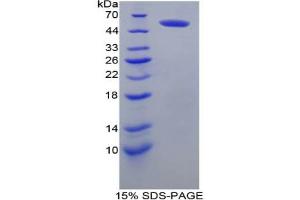 SDS-PAGE analysis of Mouse FcgR3A Protein. (FCGR3A 蛋白)