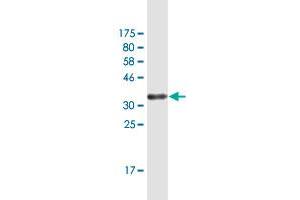 Western Blot detection against Immunogen (34. (GLIPR1 抗体  (AA 23-99))