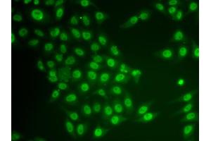 Immunofluorescence analysis of HeLa cells using CRY2 antibody (ABIN6291959). (CRY2 抗体)