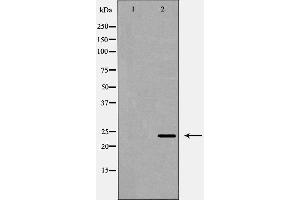 Western blot analysis of Hela whole cell lysates, using EBAG9 Antibody. (RCAS1 抗体  (C-Term))