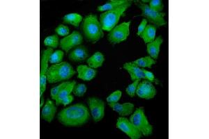 IF analysis of SND1 using anti-SND1 antibody (ABIN7600527).