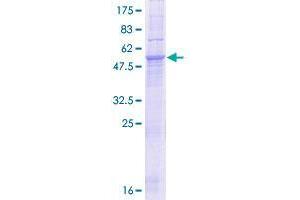 Image no. 1 for Solute Carrier Family 25 (Mitochondrial Oxodicarboxylate Carrier), Member 21 (Slc25a21) (AA 1-299) protein (GST tag) (ABIN1320262) (SLC25A21 Protein (AA 1-299) (GST tag))