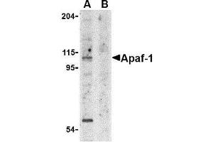 Western blot analysis of Apaf1 in K562 cell lysate with AP30055PU-N Apaf1 antibody at 1 μg/ml in the (A) absence and (B) presence of blocking peptide. (APAF1 抗体  (N-Term))