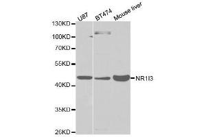 Western blot analysis of extracts of various cell lines, using NR1I3 antibody. (NR1I3 抗体  (AA 103-352))
