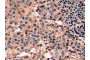 Detection of CD45 in Human Tonsil Tissue using Polyclonal Antibody to Protein Tyrosine Phosphatase Receptor Type C (CD45)