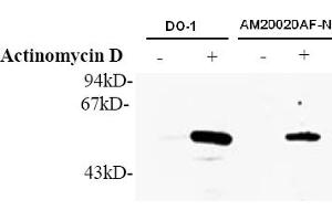 Western Blotting (WB) image for anti-Tumor Protein P53 (TP53) (AA 378-393), (pSer392) antibody (ABIN487475) (p53 抗体  (pSer392))