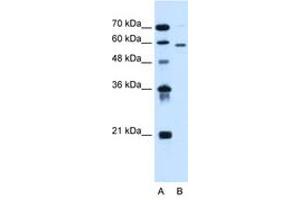 Image no. 2 for anti-Asparagine-Linked Glycosylation 11, alpha-1,2-Mannosyltransferase Homolog (Yeast) (ALG11) (AA 392-441) antibody (ABIN6736673) (ALG11 抗体  (AA 392-441))