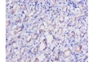 Immunohistochemistry of paraffin-embedded human kidney tissue using ABIN7151548 at dilution of 1:50 (EEF2 抗体  (AA 2-858))