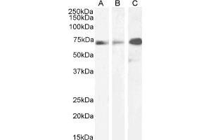 Western Blot using anti-Paxillin (LD2 Motif) antibody LD2 sAB HepG2 (A), A431 (B), and HeLa (C) cell lysate samples (35 μg protein in RIPA buffer) were resolved on a 10 % SDS PAGE gel and blots probed with the chimeric mouse IgG1 version of LD2 sAB (ABIN7072305) at 2 μg/mL before detection using an anti-mouse secondary antibody.