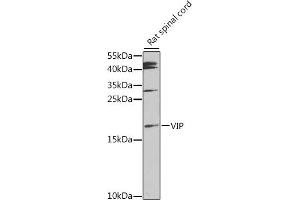 Western blot analysis of extracts of rat spinal cord, using VIP antibody (ABIN6130781, ABIN6150111, ABIN6150112 and ABIN6216193) at 1:1000 dilution. (Vip 抗体  (AA 31-170))