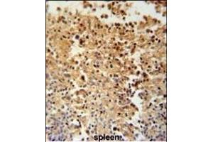 Immunohistochemistry (Paraffin-embedded Sections) (IHC (p)) image for anti-STAM Binding Protein-Like 1 (STAMBPL1) (AA 135-163) antibody (ABIN651519)