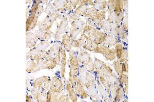 Immunohistochemistry of paraffin-embedded rat heart using MBNL1 antibody at dilution of 1:100 (x40 lens). (MBNL1 抗体)