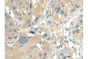 Immunohistochemistry (IHC) image for anti-Calmodulin Like Protein 3 (CALML3) (AA 1-149) antibody (ABIN7436177)