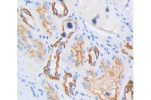 Used in DAB staining on fromalin fixed paraffin- embedded kidney tissue (SPTLC3 抗体  (AA 238-552))