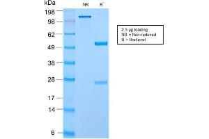 SDS-PAGE Analysis of Purified Secretory Component Rabbit Recombinant Monoclonal (ECM1/2889R). (Recombinant ECM1 抗体)