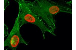 ICC/IF staining of HeLa cells treated with sodium butyrate using recombinant H4K5ac antibody (red).