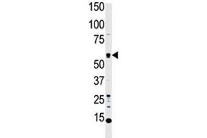 Western Blotting (WB) image for anti-serine/threonine Kinase 4 (STK4) (AA 385-415) antibody (ABIN3032542)